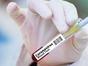 1 615 случая на коронавирус при 6945 теста, излекувани са 1 375 души
