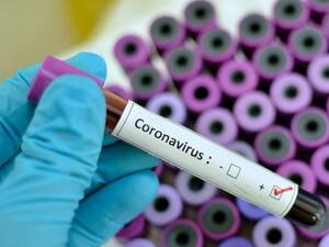 669 са новите случаи на коронавирус у нас
