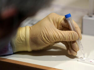 51 нови случая на коронавирус са били регистрирани през последното денонощие в България