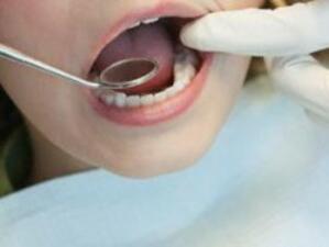 Варненски зъболекари вадели един зъб по 2 пъти
