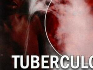 Туберкулозата – един реален бич, който се подценява от Европа