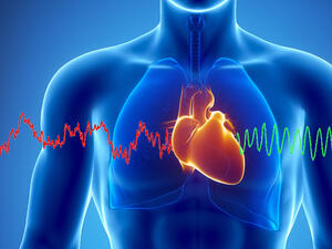 Изкуствен интелект предсказва инфаркт по-точно от лекар