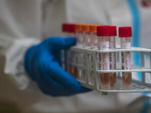 189 са новите случаи на коронавирус, 4% положителни проби