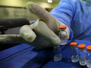 1 429 са новите случаи на коронавирус, положителни са близо 22% от тестваните