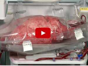 Как диша човешки бял дроб, готов за трансплантация (ВИДЕО)