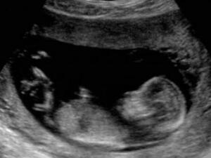 Искате ли по-ясна снимка на нероденото си дете?
